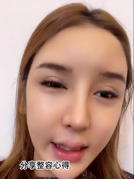 脸上有疤女网红图片