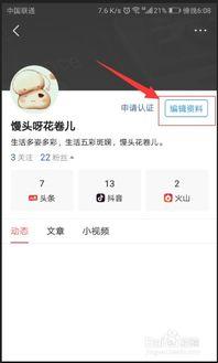 如何在头条上改名片,头条名片个性化设置，打造专属个人品牌